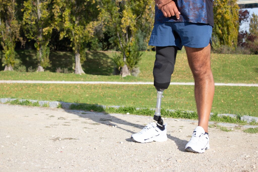 close up of caucasian man with mechanical leg