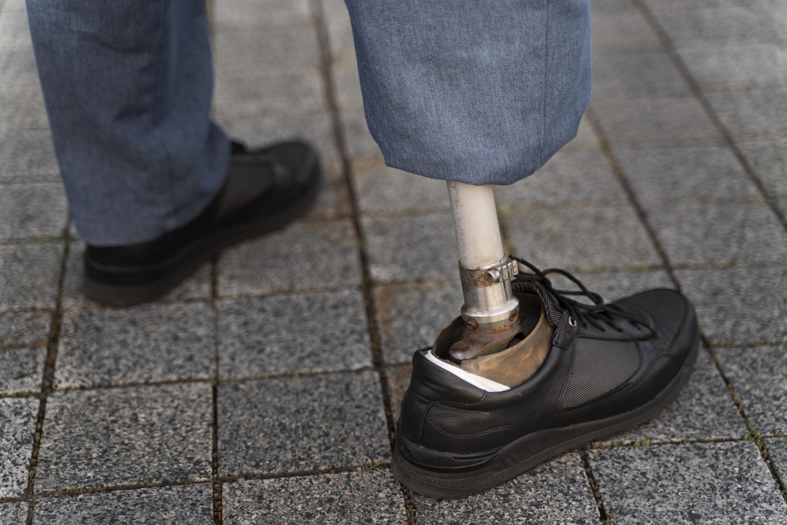 Servicios close up disabled person with leg prosthetic